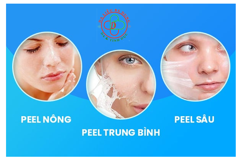 Peel da giúp mờ sẹo, tái tạo da
